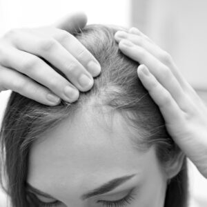 Hair Thinning/Loss
