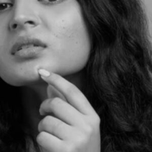 Dullness/Pigmentation
