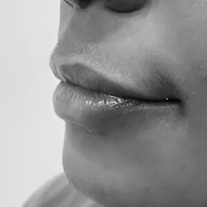 Lip Pigmentation